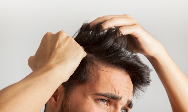 5 Factores que provocan la caída del cabello
